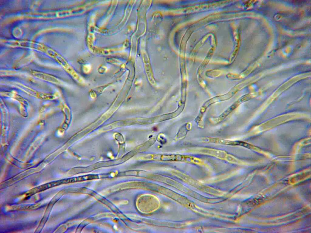 Microscopía de Tremella mesenterica - 31 - Hifas con alguna fíbula